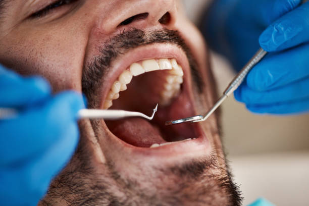 Best Dentist for Severe Toothache  in Bellville, OH